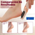 Removedor Eléctrico de Callos para Pies 2 Velocidades Recargable - Imagen 4