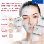 Pluma Removedora de Verrugas con Plasma 9 Niveles Display Digital USB - Imagen 3